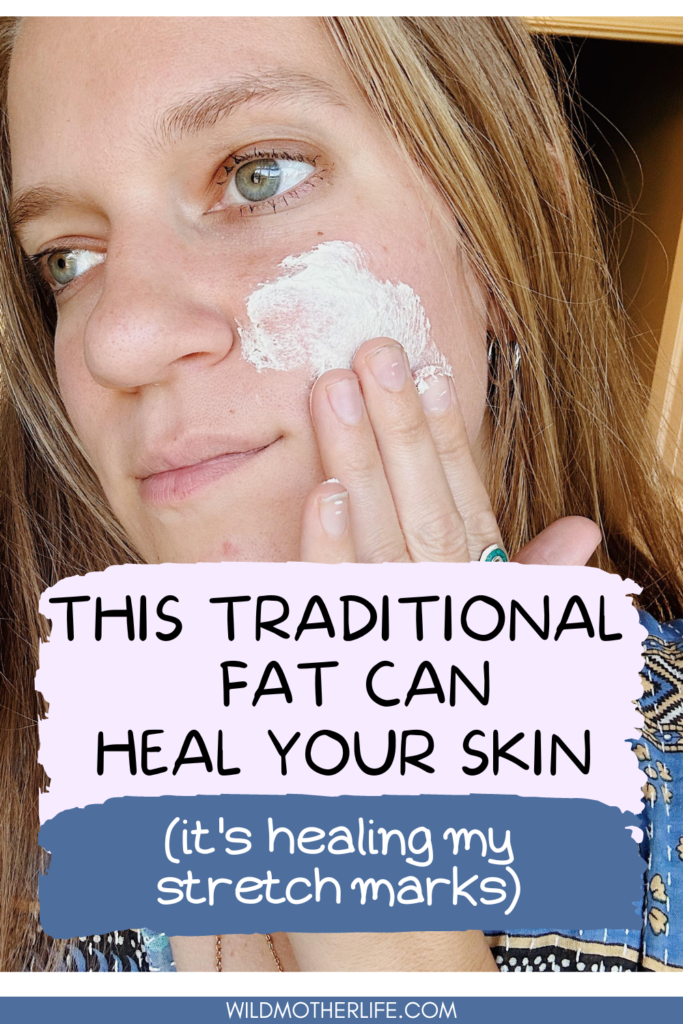 tallow can heal your skin